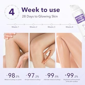 Skin Bleaching Cream, Dark Spot Remover for Body, Skin Tone Lightening for Women with Vitamin C Moisturizer, Underarm Lotion for Intimate Areas, Knees, Elbows, Bikini Line 1.7 Fl Oz