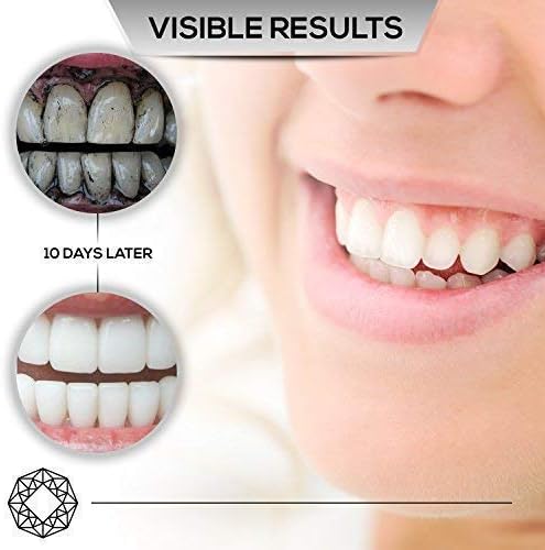 Diamond Labs | Premium Activated Carbon Charcoal Teeth Whitening Kit | Large (2oz) Size | Includes (1) FREE Bamboo Toothbrush + FREE Downloadable E-Book | Mint Flavor