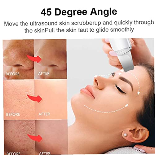 Skin Scrubber Gezicht Spatel Cleanser Acne Comedondrukker Peeling Face Lift Machine Exfoliating Beauty Instrument White… - Image 7