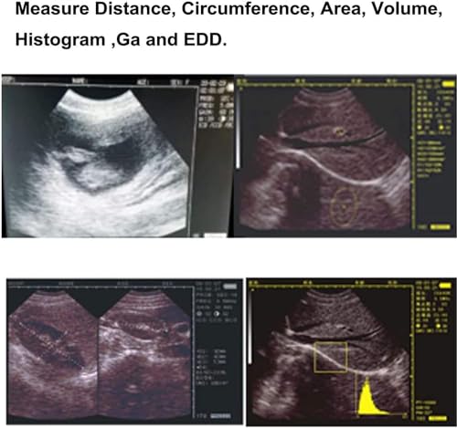 Corredo veterinario portatile dell'analizzatore di ultrasuono con la sonda da 3,5 megahertz per l'imaging diagnostico del bestiame