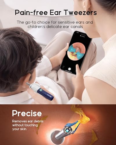 Image of Manimo Ear Cleaner Tool Kit with 1080p HD Wireless Camera & WiFi - Reusable Ear Wax Removal Tweezers, Portable Ear Cleaning Kit for Adults & Kids, Safe for Sensitive Skin - 12 Month Warranty
