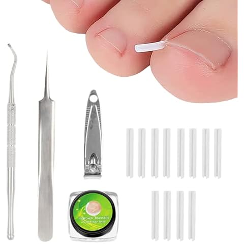 Ingrown Toenail Correction Treatment Kit with 12 Pcs Ingrown Toenail Correction Pad Recover Clips Ingrown Toenail Corrector Straightener Strips for Women Men's Nail Treatment Pedicure Tool (4 Pcs Set) Cover