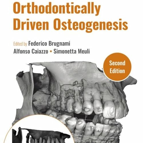 Orthodontically Driven Osteogenesis