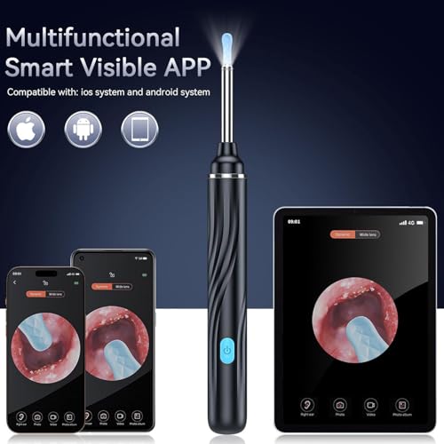 Image of Ear Wax Cleaner with Camera,1080P Ear Cleaning Tool Kit, Wireless EarScope for Adults and Kids, Ear wax Removal Tool with light (Black)