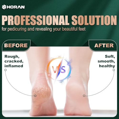 Electric Foot File Feet Hard Skin Remover, Professional Callus Remover Foot Grinder Pedicure Foot Care Utensil Cutters Accessories for Dead Skin Dry Skin, USB Rechargeable with 3 Replacement Rollers - Image 3