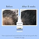 WishCare Hair Growth Serum Concentrate - Rosemary, 3% Redensyl, 4% Anagain, 2% Baicapil, Caffeine, Biotin, Plant Keratin & Rice Water - Image 4