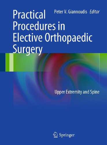 Télécharger Practical Procedures in Elective Orthopedic Surgery: Upper Extremity and Spine (English Edition) livre En ligne