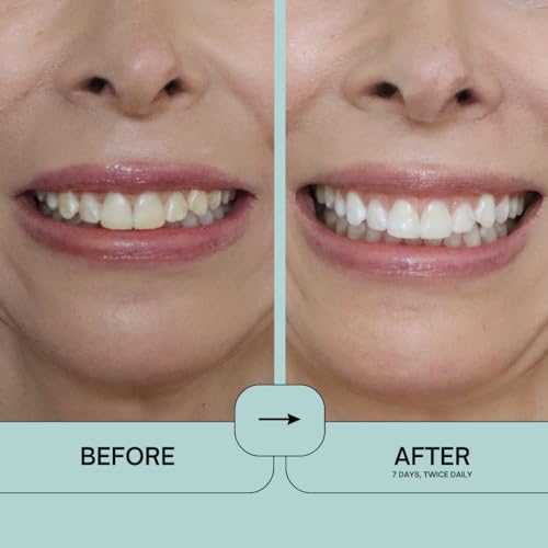 Image of IntelliWHiTE ProStrips Teeth Whitening Strips, 14 Day Treatment, Whitens Up to 12 Shades, Enamel-Safe Gentle Remineralizing Formula, Dentist Formulated for Sensitive Teeth, (28pk Mint Flavor)