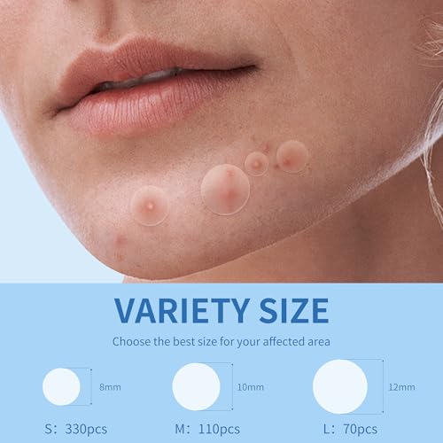 Image of Daolyo Acne Pimple Patches for Face, 3 Size 510 Ct | Hydrocolloid Patches for Covering Zits and Blemishes, Spot Stickers with Salicylic Acid, Tea Tree Oil & Calendula Oil