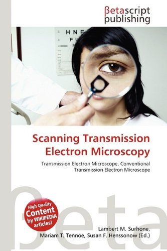 Scanning Transmission Electron Microscopy: Transmission Electron Microscope, Conventional Transmission Electron Microscope
