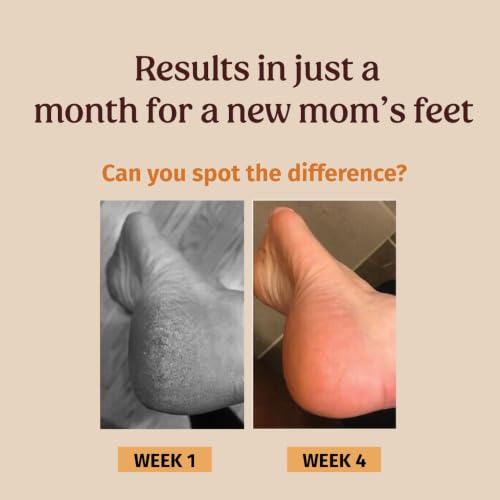 Image of Vilvah Foot Cream Combo | Pack of 2 x 100ml | Heel Repair Cream for Dry, Cracked & Rough Feet | Deeply Hydrates, Softens Dead Skin & Controls Foot Odour | Suitable for Diabetic Foot Care