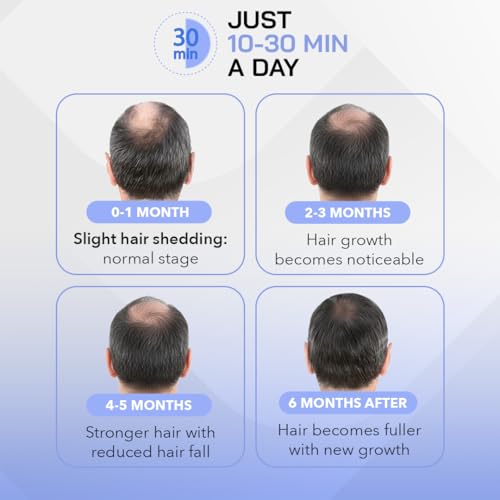 Image of SELLASTIC 2026 Upgrade HairGrow Red Light Therapy Cap - Stop 100% Hair Fall Reduction - Advance Laser Cap for Hair Growth - For Men & Women - No Side Effects - 2 Year Warranty