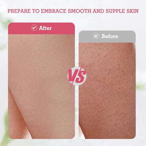 Evridwear Exfoliating Gloves for Shower, 100% Nylon Thick Soft Medium Heavy Bathing Gloves Dead Skin Remover Body Scrubber Smooth Skin with Hang Loop, 2 Pairs Moderate Pink