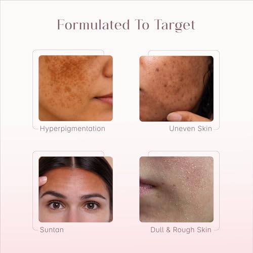 Image of Seoulskin Kojic Acid Skin Lightening Cream, Pack of 2 | With Kojic Acid, Niacinamide & Alpha Arbutin | Skin Brightening Moisturizer for Glowing Skin | Helps Reduce Dark Spots, Pigmentation & Tan | For Men & Women