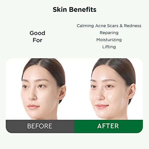 Dewytree Ultra Vitalizing Snail Face Repair Ampoule Serum – Facial Serum With Snail Secretion Filtrate – Anti Aging Serum – Korean Skin Care – Cruelty Free, Paraben Free, 2.37 Fl.oz #TOP5