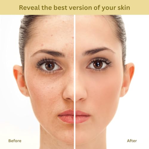 Image of Vitamin C Face Serum for Glowing Skin 30ml | 100%Natural | Brightening & Skin Radiance Booster with Damask Rose Oil, Vitamin E & Herbal Extracts | Reduces Dark Spots, Pigmentation & Dullness | Boosts Collagen Production | Lightweight Non-Sticky Face Serum for Men & Women | 30ml