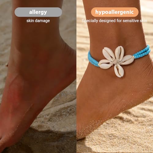 Image of Shell Anklets for Women Shell Beach Jewelry Accessories White Pink Black Flower Ankle Bracelet Summer Vacation Dress Outfits