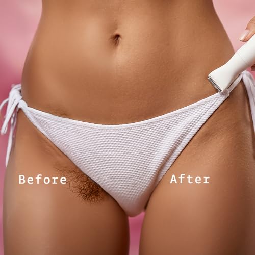 Image of Women's Trimmer 8-in-1 Rechargeable Grooming Kit | Bikini Trimmer for Woman | Face & Body Hair Removal, Underarm | Cordless, USB Charging | Gentle, Painless & Safe
