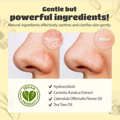 Lattcare – Calendula Nose Pore Strips (6Pcs) / Dalgona Skin Shield Patches (15Pcs) – Blackhead Remover, Deeply Cleansing, Strips-Soothing Eczema, Shrinks Pores– Hydrocolloid Acne Pimple Blemish Patches, Cruelty-Free – Absorb Fluid And Reduce Concern, Cute Shape, Vegan And Cruelty-Free Skincare #TOP2