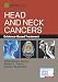 Head and Neck Cancers: Evidence-Based Treatment