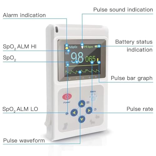 Oxímetro de pulso de mano veterinario, mide con precisión la saturación de oxígeno y la frecuencia cardíaca de las mascotas, incluye sonda y cable USB, ideal para perros, gatos y animales pequeños
