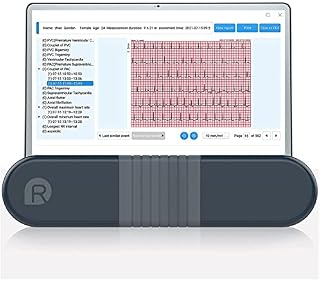 Wellue ECG Monitor, Professional Holter Recorder with AI-ECG Analysis Report, 24-hours ECG Holter Record, Support PC Software, ECG Waveform PDF Printing, Portable Heart Health Tracker for Home Use