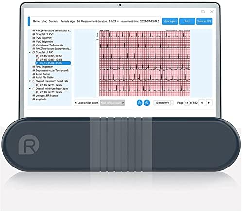 Wellue ECG Monitor, Professional Holter Recorder with AI-ECG Analysis Report, 24-hours ECG Holter Record, Support PC Software, ECG Waveform PDF Printing, Portable Heart Health Tracker for Home Use