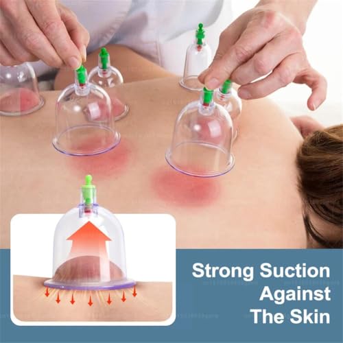 Electric Cupping Set – Battery-Powered Handheld Vacuum Suction Cups for Body Back Massage, Anti-Cellulite Massage Cupping Jars miniatura 6