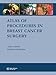 Produktbild Atlas of Procedures in Breast Cancer Surgery
