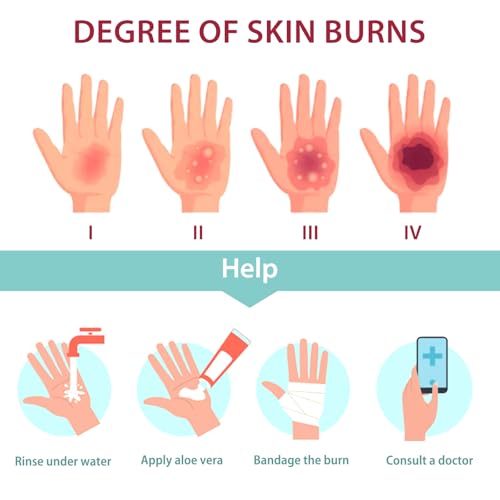 Image of Burn Wound Packing Trainer, Burn Moulages Kit, Adhesive Skin Burn Wound Trainer for Wound Care Training, Burn Wound Training Model