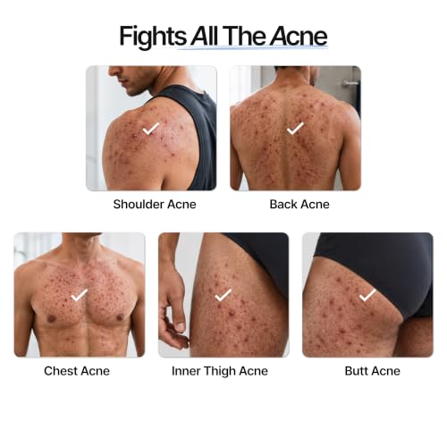 Image of Mannlich 2% Salicylic Acid Body Acne Wash for Men (300 ml) Pack of 3 - Bacne Clear Body Wash Men Shower Gel - 3% Niacinamide Prevents Body Acne, Exfoliates & Nourishes Skin - Suitable for All Skin Types - Paraben & SLS Free