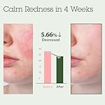 Blithe Korean Skin Care Products 6 Leaves Clear Essence for Rosacea & Redness Relief, BHA Toner Cooling Moisturizer for Face, Blackhead Treatment, Evening Primrose Wintergreen Green Tea 1.83 Oz - Image 3