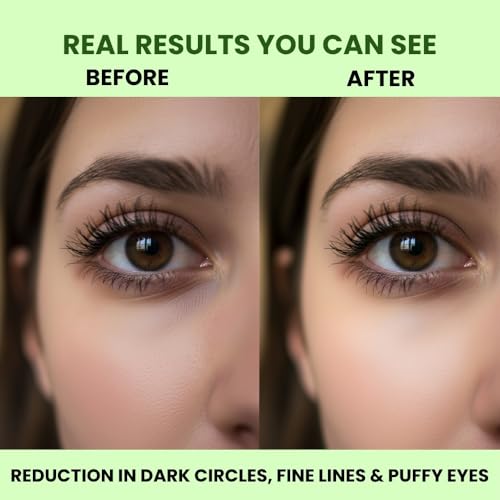 Image of Carbamide Forte Hydrogel Under Eye Patches (Pack of 2)