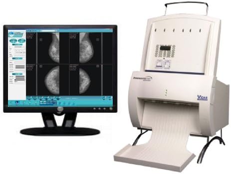 PREOWNED Vidar MAMMOGRAPHY Film DIGITIZING System - Scanner, PC and Software