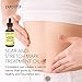 PURA D'OR Organic Scar & Stretch Mark Treatment Oil (1oz) For Skin - With Rosehip, Wheat Germ, Argan, Tamanu, Carrot, Rosemary, Lavender, Geranium, Patchouli, Sage