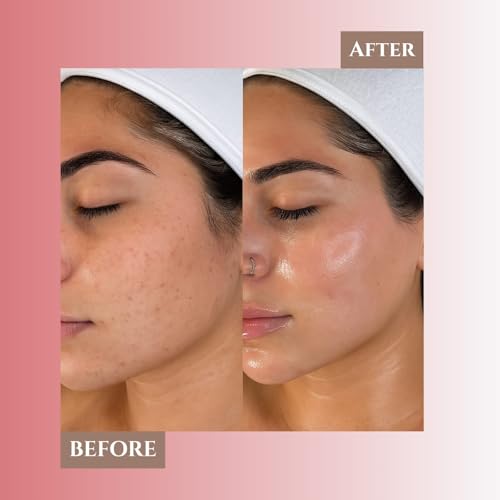 Image of KERATOPLUS Japanese Cherry Blossom Facial Kit | Niacinamide and Pro-Vitamin B5 | Plant Based Ceramides | Infused with Cherry Extracts | Dermatological Tested | 10 Steps Facial for All Skin Types