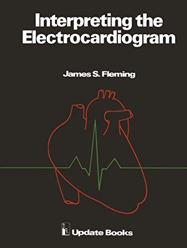 Interpreting the Electrocardiogram view 2