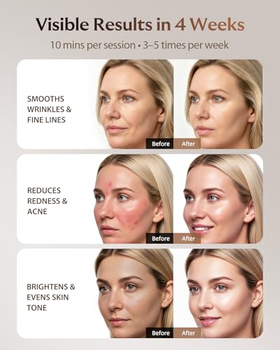 76% Off Red Light Therapy Mask with Code 75Z49UPR - Image 4