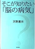 そこが知りたい「脳の病気」