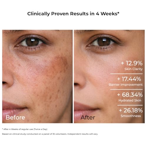 Image of Biomlogy 14 Skin Essentials Multi Active Face Serum 38.5% Actives with 20% Niacinamide, 2% Vitamin C, 2% Ceramide | Helps Improve Overall Skin Clarity & Smoothness in 4 Weeks | Fades Dark Spots|10ML