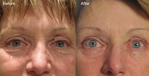 Dna Code Skin Care Anti-Aging- Magic Dmae+Msm+Niacin Firming Cream, 100% Pure Hyaluronic Acid, Argireline, Matrixyl 3000 2 Ounce #TOP2