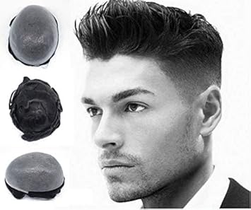 toupee hair replacement system