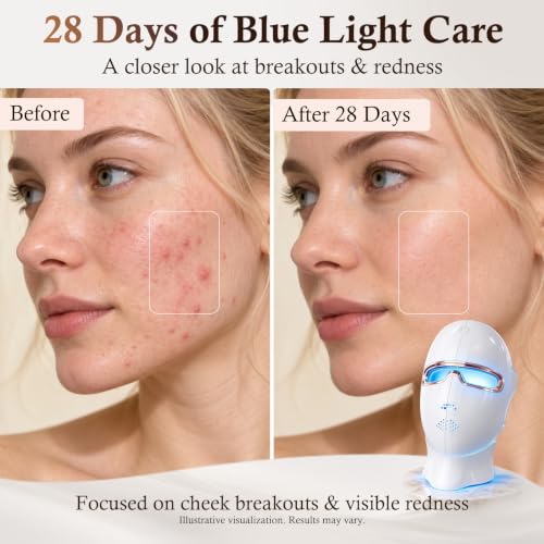 Red Light Therapy Mask for Face, 850nm NIR Treats Acne Wrinkles DROPS TO - image 6
