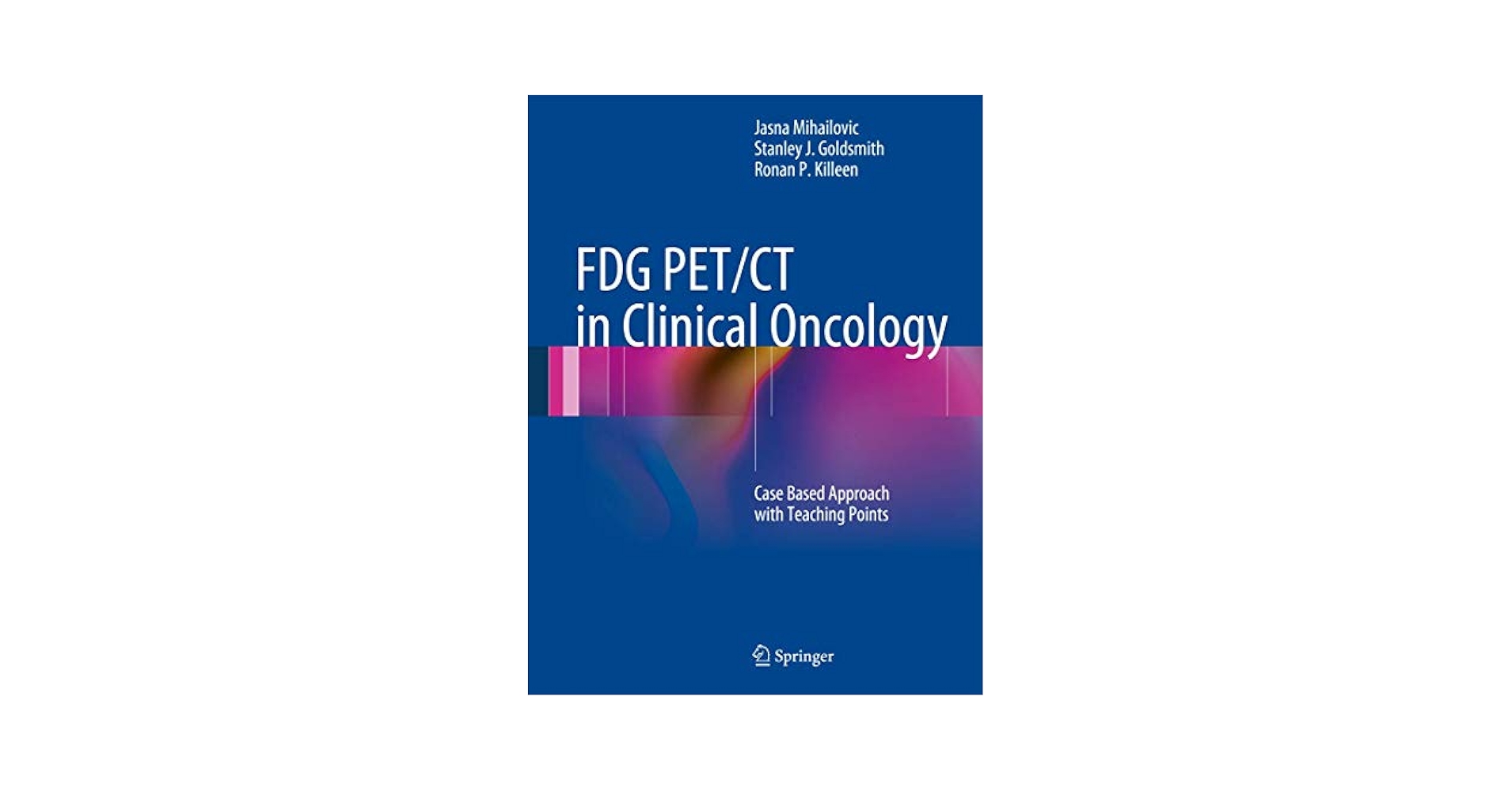 健康・医学 PET in Clinical Oncology Amazon | FDG PET/CT in Clinical Oncology: Case Based