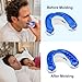 VitalSleep Anti-Snoring Mouthpiece + Cleaner, Men's Size – Adjustable, Custom-Fit Snoring Remedy – Comfortable Sleep Aid Mouthguard for Restful Nights – USA-Made, FDA-Cleared