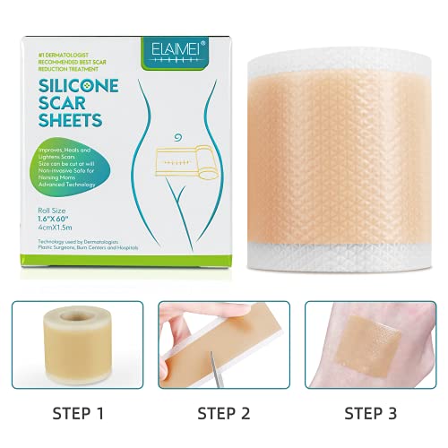 Medical Grade Silicone Scar Sheets, Silicone Scar Tape (1.6”X 60”), Scar Removal Strips For Acne Scars C-Section & Keloid Surgery Scars Sheets Treatment Sheets - 6-8 Month Supply #TOP7