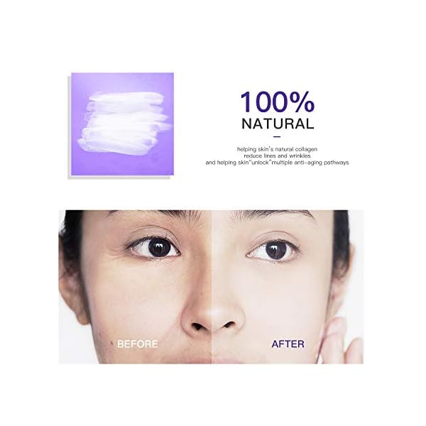 HOPEMATE-Premium-Retinol-Cream-Anti-Aging-Moisturizer-Cream-25-for-Face-and-Eye-Care-Anti-Wrinkle-Essence-with-Hyaluronic-Acid-Vitamin-E-and-Green-Tea-Day-and-Night-Cream-17-FlOz-50ml HOPEMATE Retinol Cream, Anti-Aging Moisturizer Cream 2.5% for Face and Eye Care, Anti-Wrinkle Essence with Hyaluronic Acid, Vitamin E and Green Tea, Day and Night Cream, 1.7 Fl.Oz, 50ml