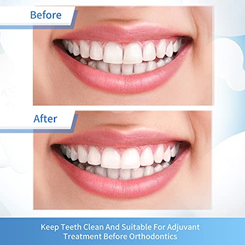 Dental Polishing Strips, Teeth Abrasive & Finishing Strips 4Mm X 6M, Inter-Dental Oral Care Cleaning Tool - Sanding Grinding Whitening Teeth (Blue) - 12 Months Warranty #TOP5