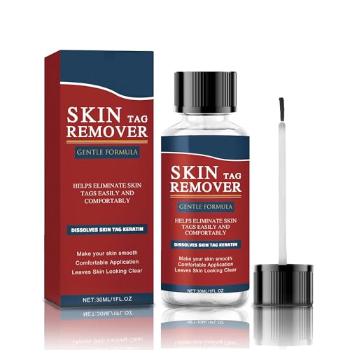 Quita Verrugas-30ml, Verrugas Quitar, Skin Tag Remover, Eliminar Verruga, Wart Remover para La Mayoría de Las Partes Del Cuerpo, Rápida y Eficaz,Suave y seguro