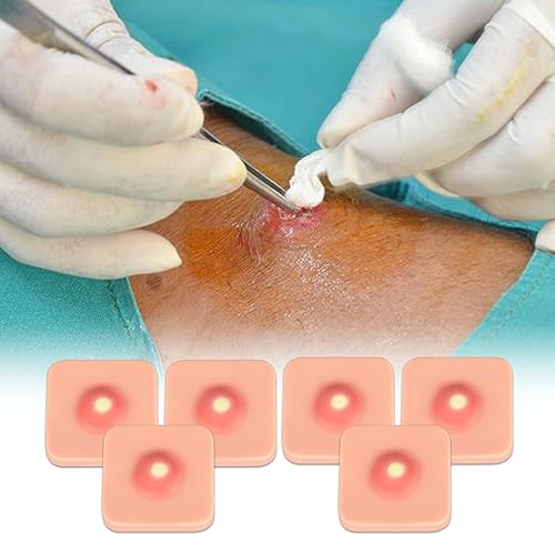 Image of Ultrassist Abscess I&D Incision and Drainage Pad (6-Pack), Sebaceous Cyst Removal Trainer, Suture Practice Skin Pad for Medical Education